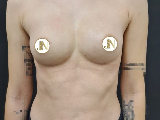 povecanje-vlas-tkivom2